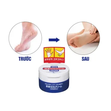 Kem trị nứt nẻ gót tay chân Shiseido Urea Cream 100g – Giải pháp phục hồi làn da mềm mại, giảm thô ráp từ Nhật Bản